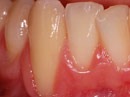 gallery/gum